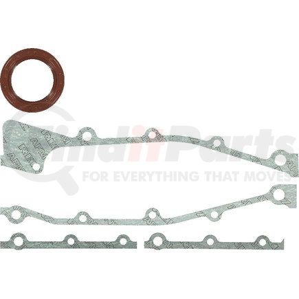 REINZ 15-22603-02 Engine Timing Chain Case